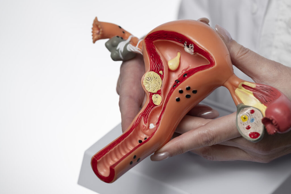 The current image has no alternative text. The file name is: hand-holding-uterus-ovary-model-scaled.jpg